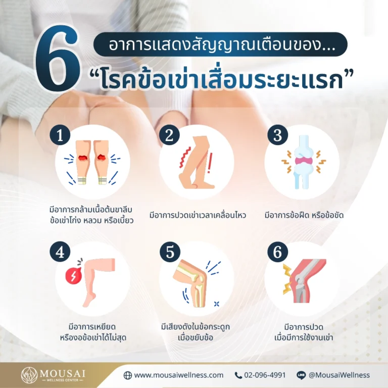 โปรแกรมตรวจสุขภาพเข่า PRP – 6 สัญญาณ‘ โรคข้อเข่าเสื่อมระยะแรก ’