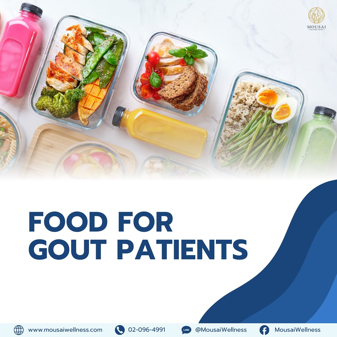 Foods for Gout Patients: What to Eat and What to Avoid!