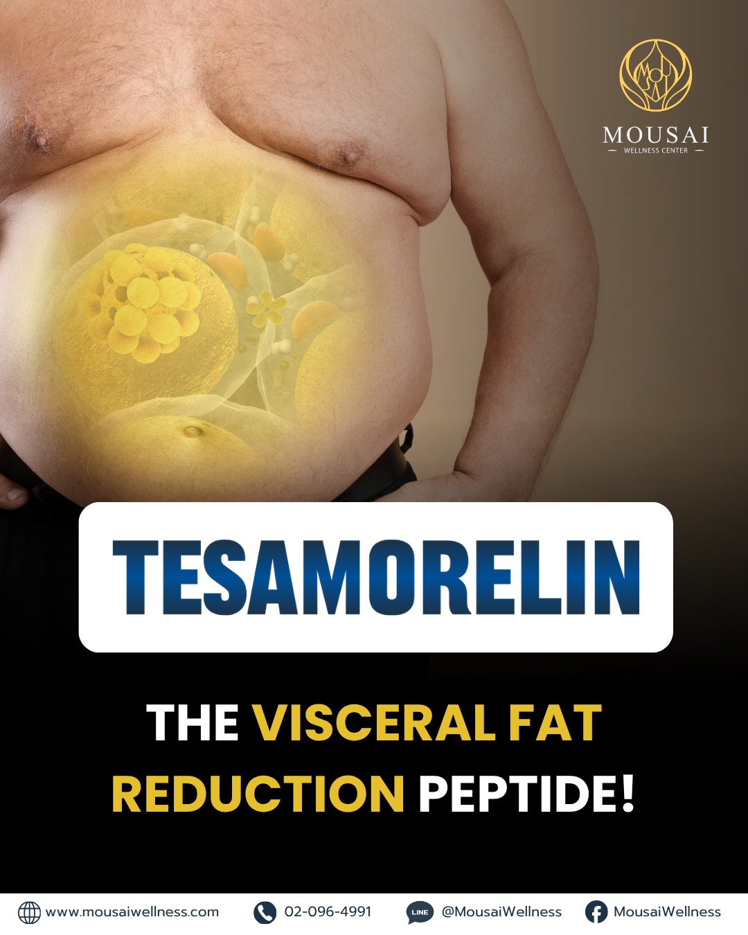 TESAMORELIN